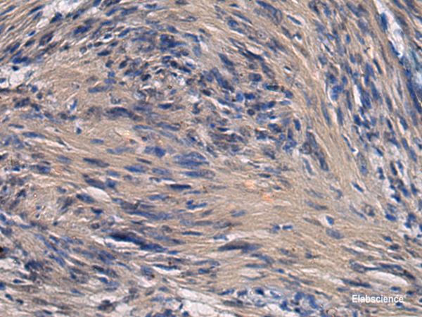 Immunohistochemistry of paraffin-embedded Human brain tissue using ICA1 Polyclonal Antibody at dilution of 1:70(×200)