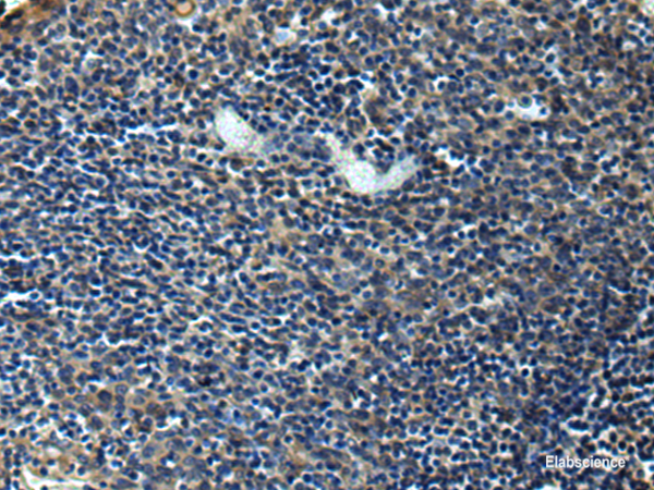 Immunohistochemistry of paraffin-embedded Human tonsil tissue using ERLIN1 Polyclonal Antibody at dilution of 1:50(×200)
