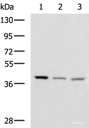 Western blot analysis of Human cerebrum tissue Human cerebella tissue Mouse brain tissue lysates using ENKD1 Polyclonal Antibody at dilution of 1:1150