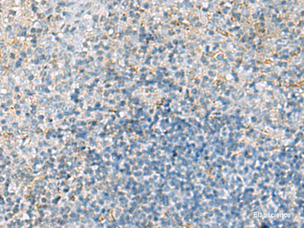Immunohistochemistry of paraffin-embedded Human tonsil tissue using EMILIN1 Polyclonal Antibody at dilution of 1:70(×200)