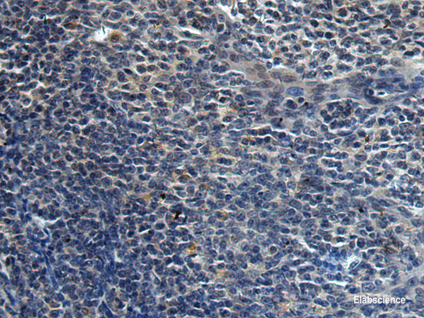 Immunohistochemistry of paraffin-embedded Human tonsil tissue using HAUS6 Polyclonal Antibody at dilution of 1:45(×200)
