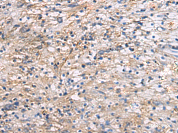 Immunohistochemistry of paraffin-embedded Human brain tissue using CEP89 Polyclonal Antibody at dilution of 1:95(×200)