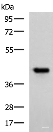 Western blot analysis of Ramos cell lysate using FCRLA Polyclonal Antibody at dilution of 1:750