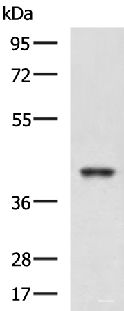 Western blot analysis of K562 and HepG2 cell lysates using RBM4 Polyclonal Antibody at dilution of 1:750