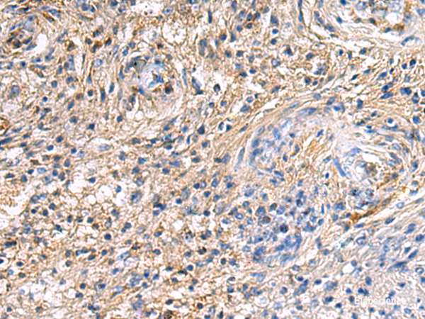 Immunohistochemistry of paraffin-embedded Human brain tissue using SAV1 Polyclonal Antibody at dilution of 1:90(×200)