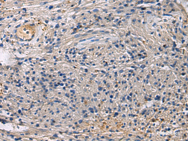 Immunohistochemistry of paraffin-embedded Human brain tissue using SLC30A3 Polyclonal Antibody at dilution of 1:55(×200)