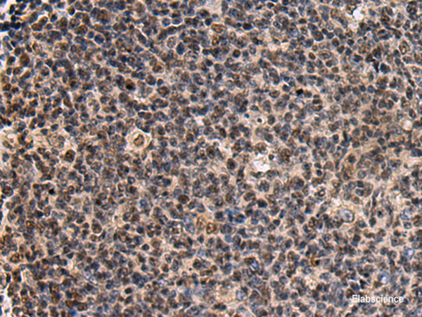 Immunohistochemistry of paraffin-embedded Human tonsil tissue using SIK3 Polyclonal Antibody at dilution of 1:60(×200)