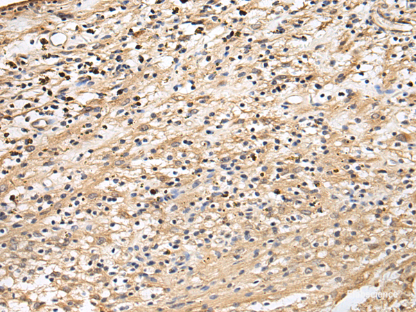 Immunohistochemistry of paraffin-embedded Human brain tissue using CRACR2A Polyclonal Antibody at dilution of 1:60(×200)