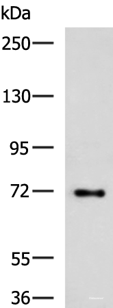 Western blot analysis of HepG2 cell lysate using TTLL10 Polyclonal Antibody at dilution of 1:850