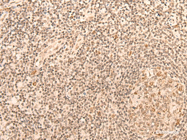 Immunohistochemistry of paraffin-embedded Human tonsil tissue using CCNE1 Polyclonal Antibody at dilution of 1:25(×200)