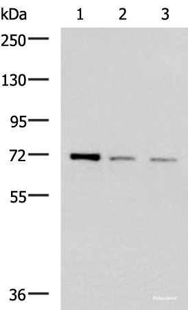 Western blot analysis of K562 HepG2 and Jurkat cell lysates using FOXK1 Polyclonal Antibody at dilution of 1:400
