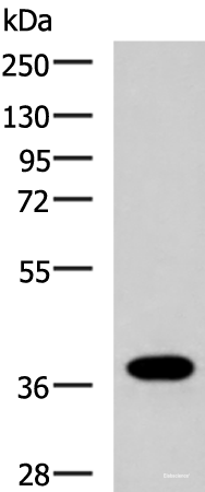 Western blot analysis of Human placenta tissue lysate using GPR6 Polyclonal Antibody at dilution of 1:1000