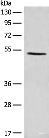 Western blot analysis of NIH/3T3 cell lysate using PTEN Polyclonal Antibody at dilution of 1:1100