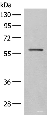 Western blot analysis of Mouse eye tissue lysate using SLC5A1 Polyclonal Antibody at dilution of 1:500