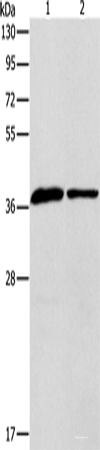 Western blot analysis of Human fetal liver tissue huvec cells using APOL2 Polyclonal Antibody at dilution of 1:725