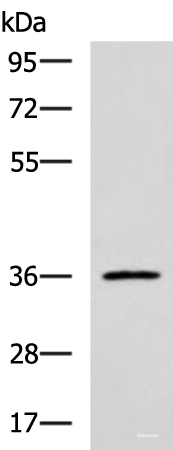 Western blot analysis of Jurkat cell lysate using IBSP Polyclonal Antibody at dilution of 1:700