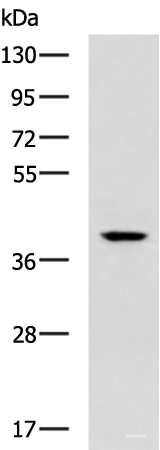 Western blot analysis of Mouse small intestines tissue lysate using TDP2 Polyclonal Antibody at dilution of 1:600