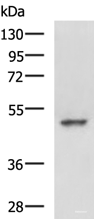 Western blot analysis of Hela cell lysate using MYCN Polyclonal Antibody at dilution of 1:800