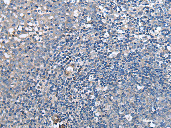 Immunohistochemistry of paraffin-embedded Human tonsil tissue using F3 Polyclonal Antibody at dilution of 1:60(×200)