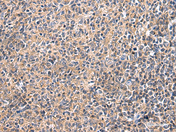 Immunohistochemistry of paraffin-embedded Human tonsil tissue using UBTD1 Polyclonal Antibody at dilution of 1:25(×200)