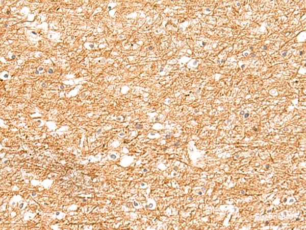 Immunohistochemistry of paraffin-embedded Human brain tissue using ZNF185 Polyclonal Antibody at dilution of 1:25(×200)