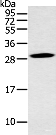 Western blot analysis of Mouse stomach tissue using YRDC Polyclonal Antibody at dilution of 1:400