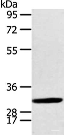 Western blot analysis of Human fetal brian tissue using CALB2 Polyclonal Antibody at dilution of 1:400