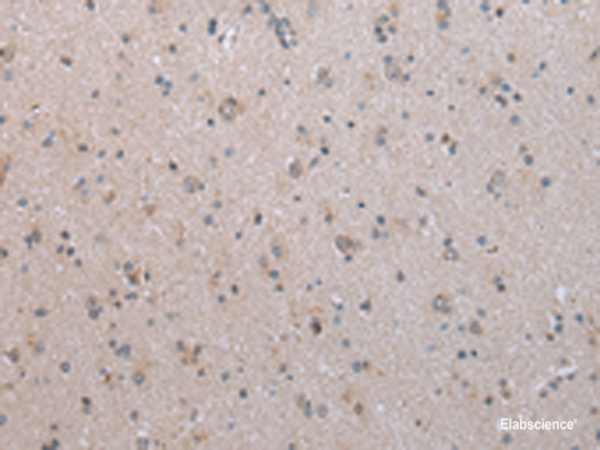 Immunohistochemistry of paraffin-embedded Human brain tissue using COX17 Polyclonal Antibody at dilution of 1:45(×200)