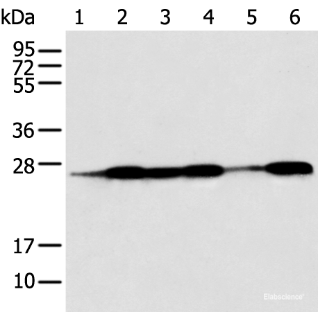 Western blot analysis of Human fetal muscle tissue HEPG2 Jurkat Hela A431 and A549 cell using BAG2 Polyclonal Antibody at dilution of 1:550