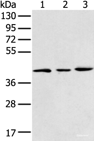 Western blot analysis of 293T K562 and Raji cell using DCX Polyclonal Antibody at dilution of 1:400