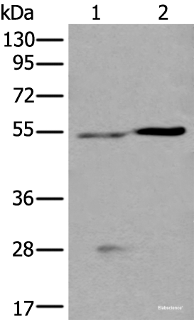 Western blot analysis of Human left kidney tissue and Human fetal liver tissue lysates using DDC Polyclonal Antibody at dilution of 1:400
