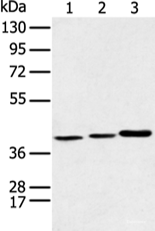 Western blot analysis of Human fetal liver tissue Hela cell and Human fetal brain tissue using MORF4L1 Polyclonal Antibody at dilution of 1:350