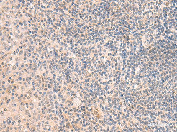 Immunohistochemistry of paraffin-embedded Human tonsil tissue using GRM2 Polyclonal Antibody at dilution of 1:50(×200)