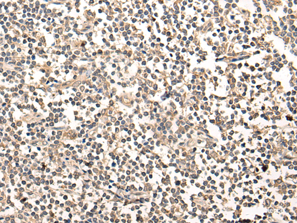 Immunohistochemistry of paraffin-embedded Human tonsil tissue using MAGEA1 Polyclonal Antibody at dilution of 1:65(×200)