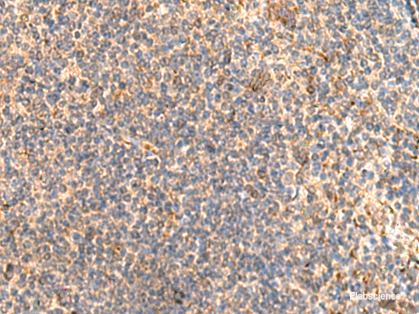 Immunohistochemistry of paraffin-embedded Human tonsil tissue using ABHD2 Polyclonal Antibody at dilution of 1:40(×200)