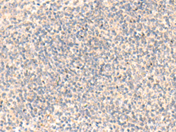 Immunohistochemistry of paraffin-embedded Human tonsil tissue using ADAMTS2 Polyclonal Antibody at dilution of 1:45(×200)