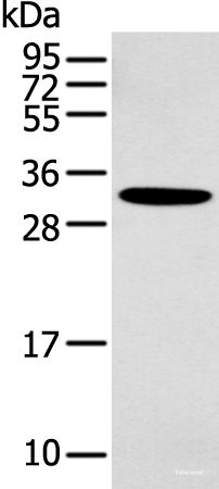 Western blot analysis of Mouse muscle tissue using NANOS1 Polyclonal Antibody at dilution of 1:400