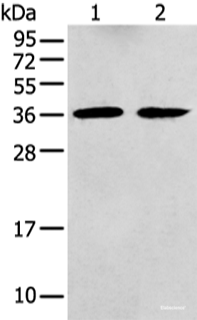 Western blot analysis of Mouse brain tissue and Human fetal brain tissue using GNAI2 Polyclonal Antibody at dilution of 1:400
