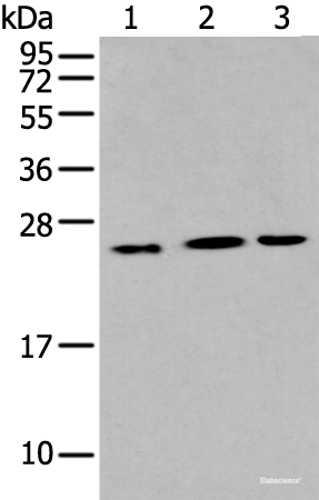 Western blot analysis of Hepg2 Hela and A549 cell using IL6 Polyclonal Antibody at dilution of 1:400