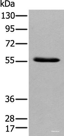 Western blot analysis of Human pancreas tissue using GPC4 Polyclonal Antibody at dilution of 1:500
