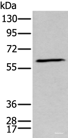 Western blot analysis of Human fetal brain tissue lysate using GPC5 Polyclonal Antibody at dilution of 1:450
