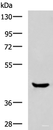 Western blot analysis of Human muscle tissue lysate using HOXA2 Polyclonal Antibody at dilution of 1:800