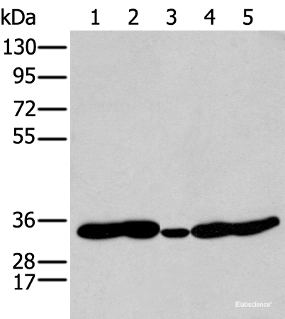 Western blot analysis of 231 Mouse heart tissue Human fetal brain tissue Jurkat and Hepg2 cell using HOXC11 Polyclonal Antibody at dilution of 1:250