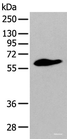 Western blot analysis of Human prostate tissue using STEAP2 Polyclonal Antibody at dilution of 1:400