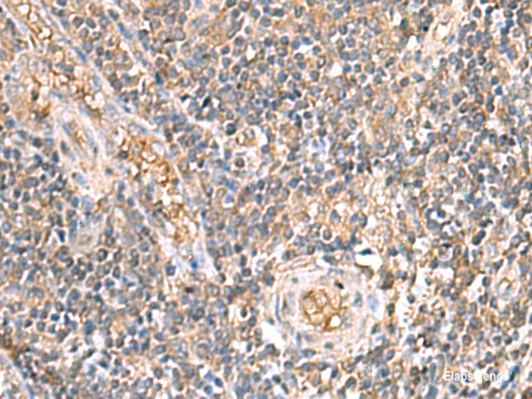 Immunohistochemistry of paraffin-embedded Human tonsil tissue using ARF5 Polyclonal Antibody at dilution of 1:40(×200)