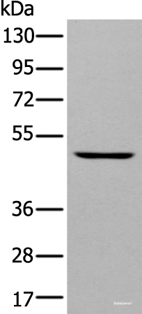 Western blot analysis of A431 cell using DAPK2 Polyclonal Antibody at dilution of 1:400