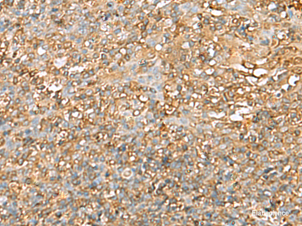 Immunohistochemistry of paraffin-embedded Human tonsil tissue using LGALS9 Polyclonal Antibody at dilution of 1:40(×200)