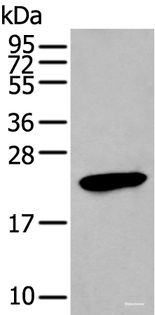 Western blot analysis of Human stomach tissue lysate using GKN1 Polyclonal Antibody at dilution of 1:250