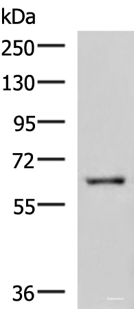 Western blot analysis of HepG2 cell lysate using LILRB5 Polyclonal Antibody at dilution of 1:600