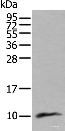 Western blot analysis of Human lung tissue lysate using CCL18 Polyclonal Antibody at dilution of 1:400